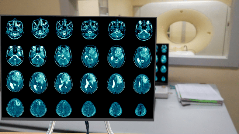 Recent Advancements in Glioblastoma Studies