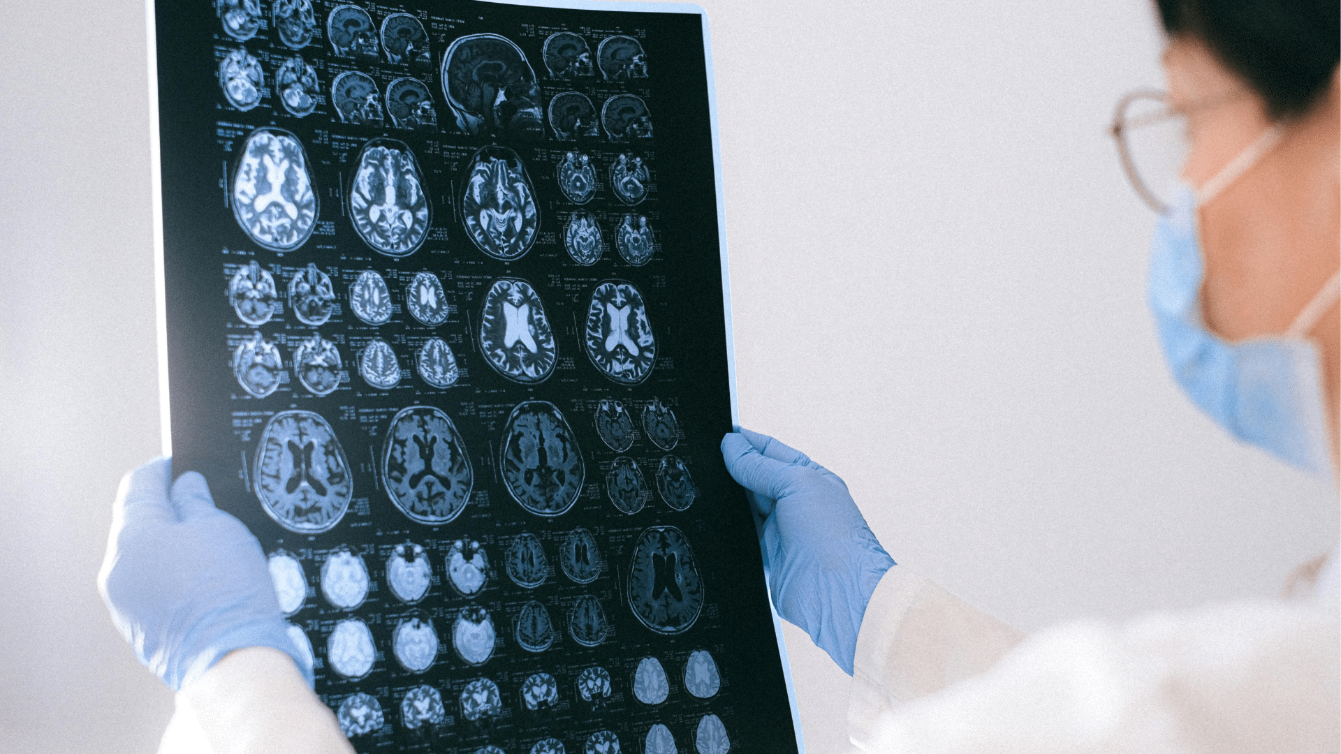Imaging Agent Surgical Resection Brain Tumor